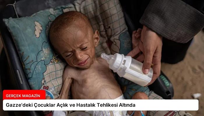 Gazze’deki Çocuklar Açlık ve Hastalık Tehlikesi Altında
