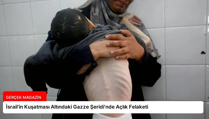 İsrail’in Kuşatması Altındaki Gazze Şeridi’nde Açlık Felaketi