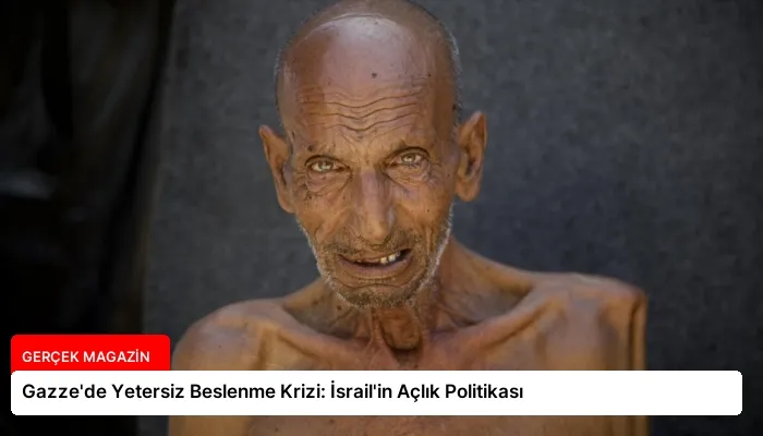 Gazze’de Yetersiz Beslenme Krizi: İsrail’in Açlık Politikası